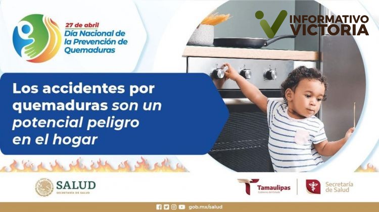 Refuerza Secretaría de Salud de Tamaulipas acciones de prevención de quemaduras