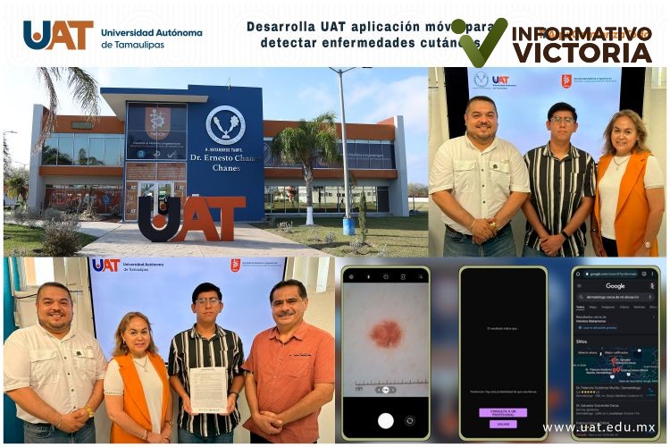 UAT desarrolla una aplicación móvil para detectar enfermedades de la piel