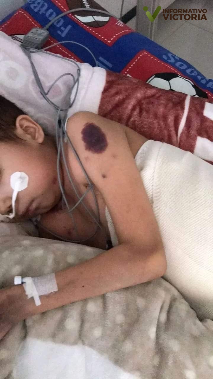 ¡Ayudemos a Yrving!; negligencia del Hospital Infantil lo mantiene al borde la muerte